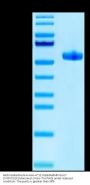 Biotinylated Human HLA-A*11:01&B2M&HPV16 E7 (IVCPICSQK) Monomer Protein (MHC-HM464B)