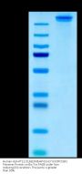 Human HLA-A*11:01&B2M&HPV16 E7 (IVCPICSQK) Tetramer Protein (MHC-HM464T)