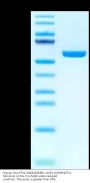 Human HLA-E*01:03&B2M&EBV LMP1 (GGDPHLPTL) Monomer Protein (MHC-HM466)