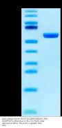 Biotinylated Human HLA-E*01:03&B2M&EBV LMP1 (GGDPHLPTL) Monomer Protein (MHC-HM466B)