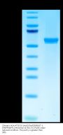 Chimeric HLA-A*02:01 (mα3) &mB2M&WT-1 (RMFPNAPYL) Monomer Protein (MHC-HM467)