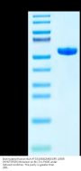 Biotinylated Human HLA-A*33:03&B2M&EGFR L858R (HVKITDFGR) Monomer Protein (MHC-HM471B)
