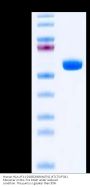 Human HLA-A*11:01&B2M&MATN2 (KTLTSVFQK) Monomer Protein (MHC-HM472)