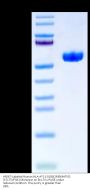 AF647-Labeled Human HLA-A*11:01&B2M&MATN2 (KTLTSVFQK) Monomer Protein (MHC-HM472AF6)