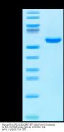 Human HLA-A*02:01&B2M&TERT (ILAKFLHWL) Monomer Protein (MHC-HM473)