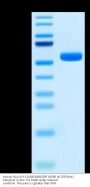 Human HLA-A*11:01&B2M&EGFR L858R (KITDFGRAK) Monomer Protein (MHC-HM478)