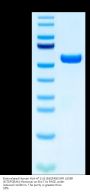 Biotinylated Human HLA-A*11:01&B2M&EGFR L858R (KITDFGRAK) Monomer Protein (MHC-HM479B)