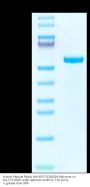 Human Peptide Ready HLA-B*07:02&B2M Monomer Protein (MHC-HM47R)