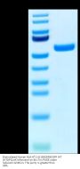 Biotinylated Human HLA-A*11:01&B2M&EGFR WT (KITDFGLAK) Monomer Protein (MHC-HM480B)