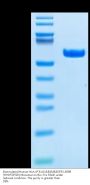Biotinylated Human HLA-A*31:01&B2M&EGFR L858R (HVKITDFGR) Monomer Protein (MHC-HM485B)