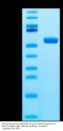 Human HLA-A*02:01&B2M&TdT (ALYDKTKRI) Monomer Protein (MHC-HM486)