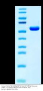 Human HLA-A*02:01&B2M&TdT (ALYDKTKRIFL) Monomer Protein (MHC-HM487)