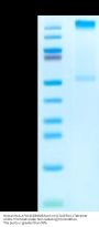Human HLA-A*02:01&B2M&Survivin (LTLGEFLKL) Tetramer Protein (MHC-HM4A1T)