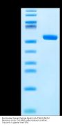 Biotinylated Human Peptide Ready HLA-A*68:01&B2M Monomer Protein (MHC-HM4R1B)