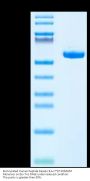 Biotinylated Human Peptide Ready HLA-C*07:02&B2M Monomer Protein (MHC-HM59RB)