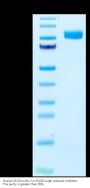Human CD10/MME Protein (MME-HM010)