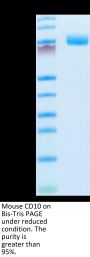 Mouse CD10/MME Protein (MME-MM110)