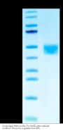 Cynomolgus MSLN/Mesothelin Protein (MSL-CM281)