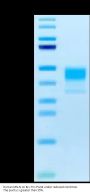 Human MSLN/Mesothelin Protein, Ultra Low Endotoxin (MSL-HM181-UL)