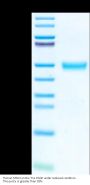 Human MSLN/Mesothelin Protein (MSL-HM181)
