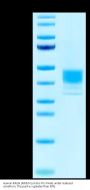 Human MSLN/Mesothelin (M593V) Protein (MSL-HM182)
