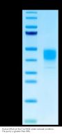 Human MSLN/Mesothelin Protein (MSL-HM183)