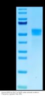 Human MSLN/Mesothelin Protein (MSL-HM20D)