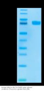 Human MSLN/Mesothelin Protein (MSL-HM280)
