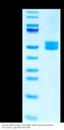 Human MSLN/Mesothelin Protein (MSL-HM2D1)