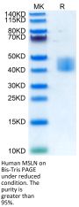 Human MSLN/Mesothelin Protein (MSL-HM480)