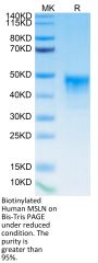 Biotinylated Human MSLN/Mesothelin Protein (MSL-HM480B)
