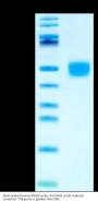 Biotinylated Human MSLN/Mesothelin Protein (MSL-HM481B)