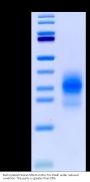 Biotinylated Human MSLN/Mesothelin Protein (MSL-HM4D1B)