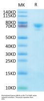 Biotinylated Human MSLN/Mesothelin Protein (MSL-HM580B)