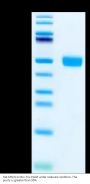Rat MSLN/Mesothelin Protein (MSL-RM180)