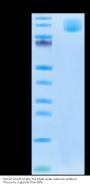 Human CA125/MUC16 Protein (MUC-HM126)