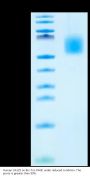 Human CA125/MUC16 Protein (MUC-HM416)