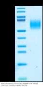 Biotinylated Human CA125/MUC16 Protein (MUC-HM416B)