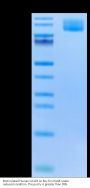 Biotinylated Human CA125/MUC16 Protein (MUC-HM426B)