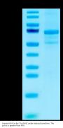 Human MVK Protein (MVK-HB101)
