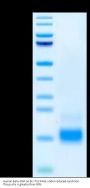 Human Beta-NGF Protein (NGF-HM00B)