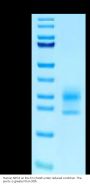 Human NPC2 Protein (NPC-HM102)