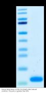 Human NRG1 Beta 1 Protein (NRG-HM1B1)