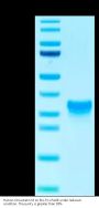 Human Oncostatin M/OSM Protein (ONM-HM101)
