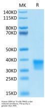 Human Oncostatin M/OSM Protein (ONM-HM401)