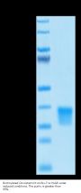 Biotinylated Human Oncostatin M/OSM Protein (ONM-HM401B)