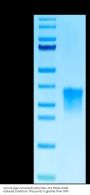 Cynomolgus Oncostatin M/OSM Protein (OSM-CM102)