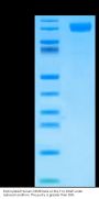 Biotinylated Human OSMR beta Protein (OSM-HM001B)