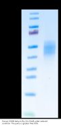 Human OSMR beta Protein (OSM-HM10D)