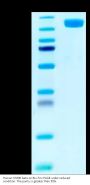 Human OSMR beta Protein (OSM-HM201)